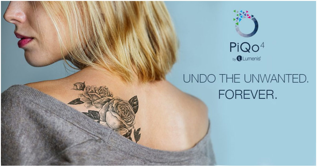 Laser Tattoo Removal with PiQo4