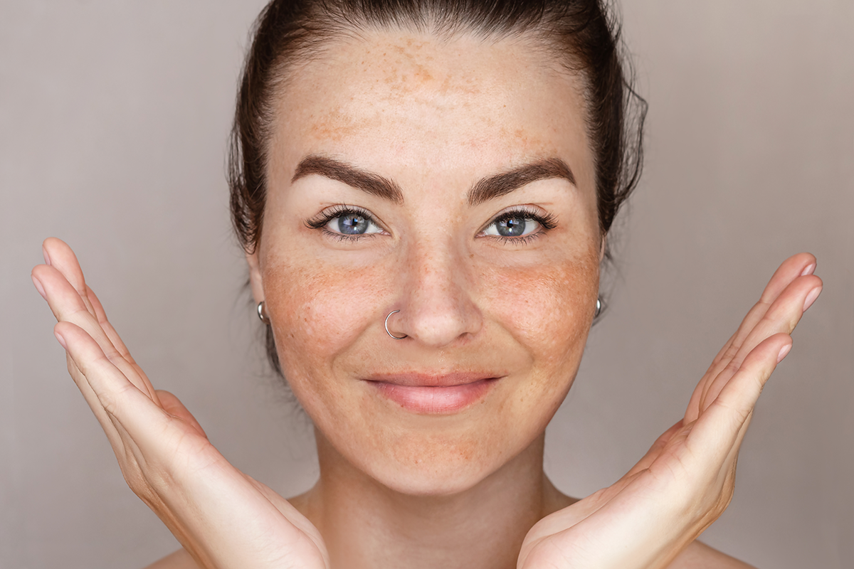 Caucasian woman's face with freckles or age spots