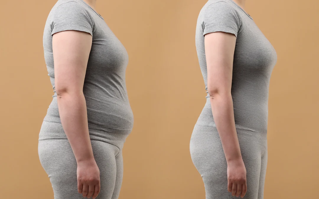 Top Body Procedures That Will Enhance Your Look for the New Year