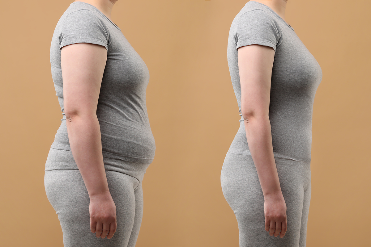Collage with photos of woman before and after weight loss on beige background