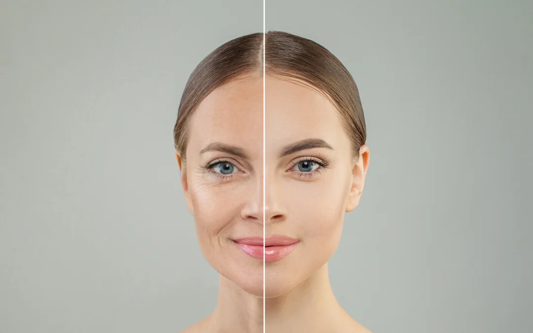 Eliminate Sagging Skin with a Brow Lift