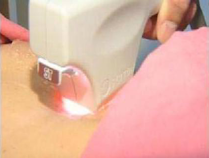 Skintyte during treatment