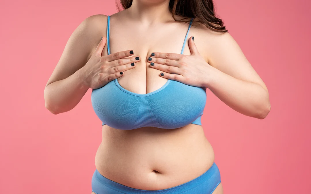 Breast Reduction – Reduction Mammaplasty Plano
