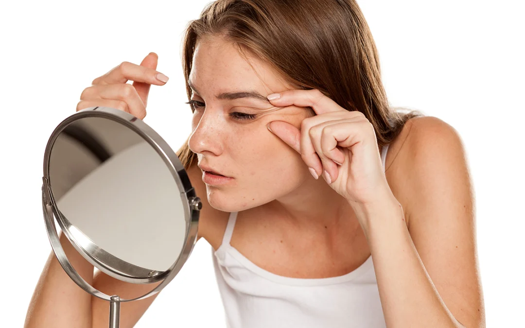 Fixing My Fine Lines with Botox