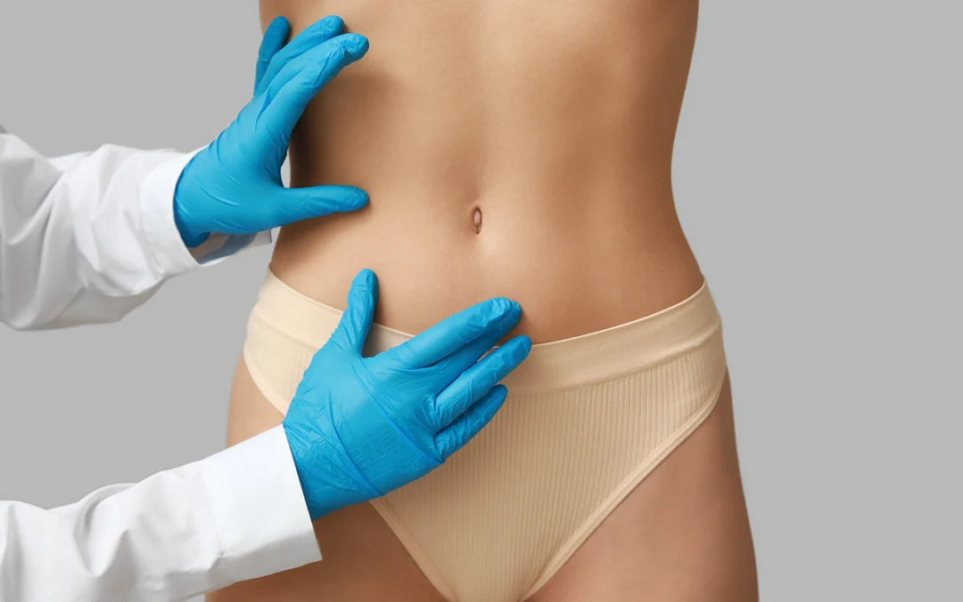 The Benefits of a Tummy Tuck Procedure